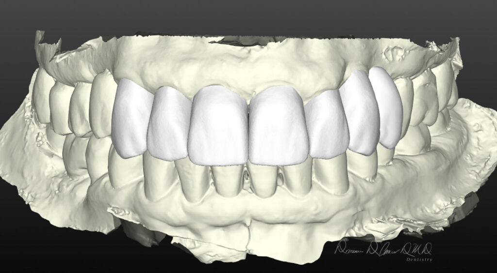 a model of a human teeth