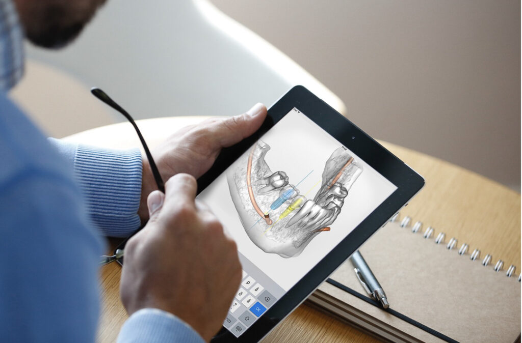 Digital caries detection systems