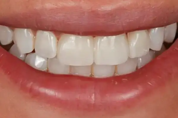 close up of a person's mouth