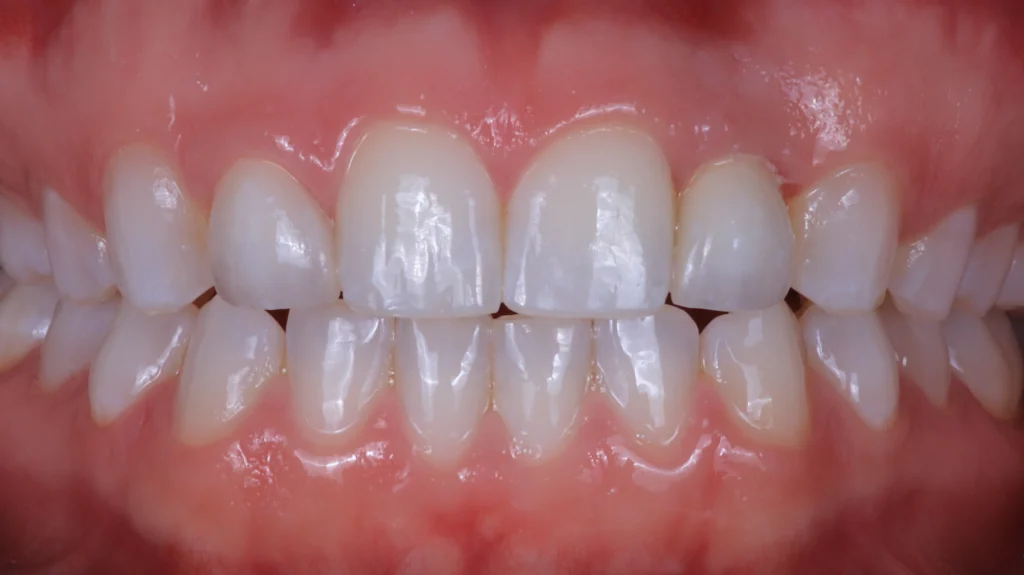 Regular dental examinations