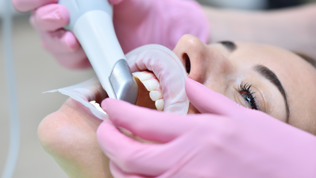 Intraoral 3D scanners