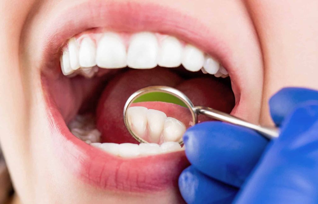 Dental Health