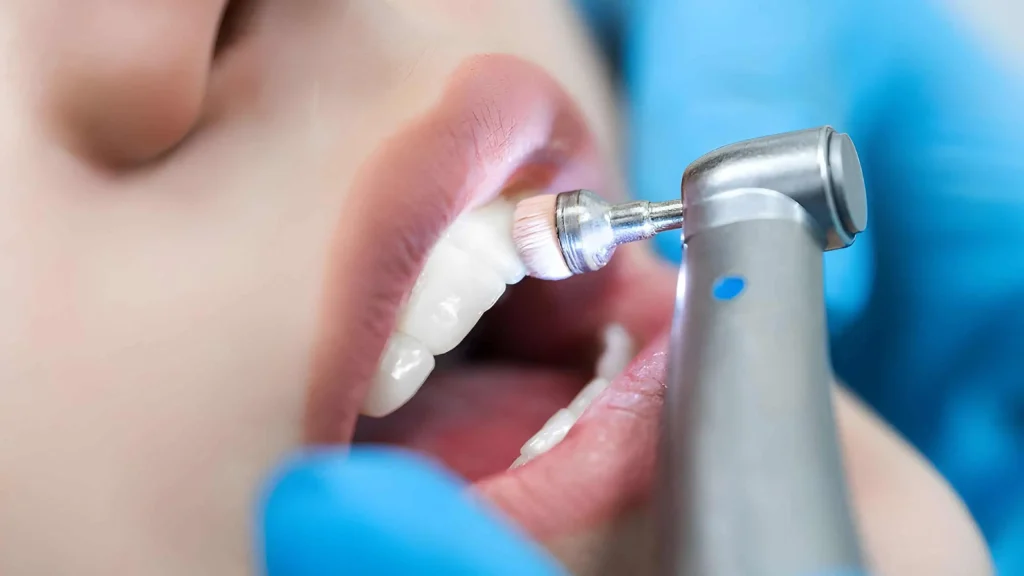 Teeth Cleaning