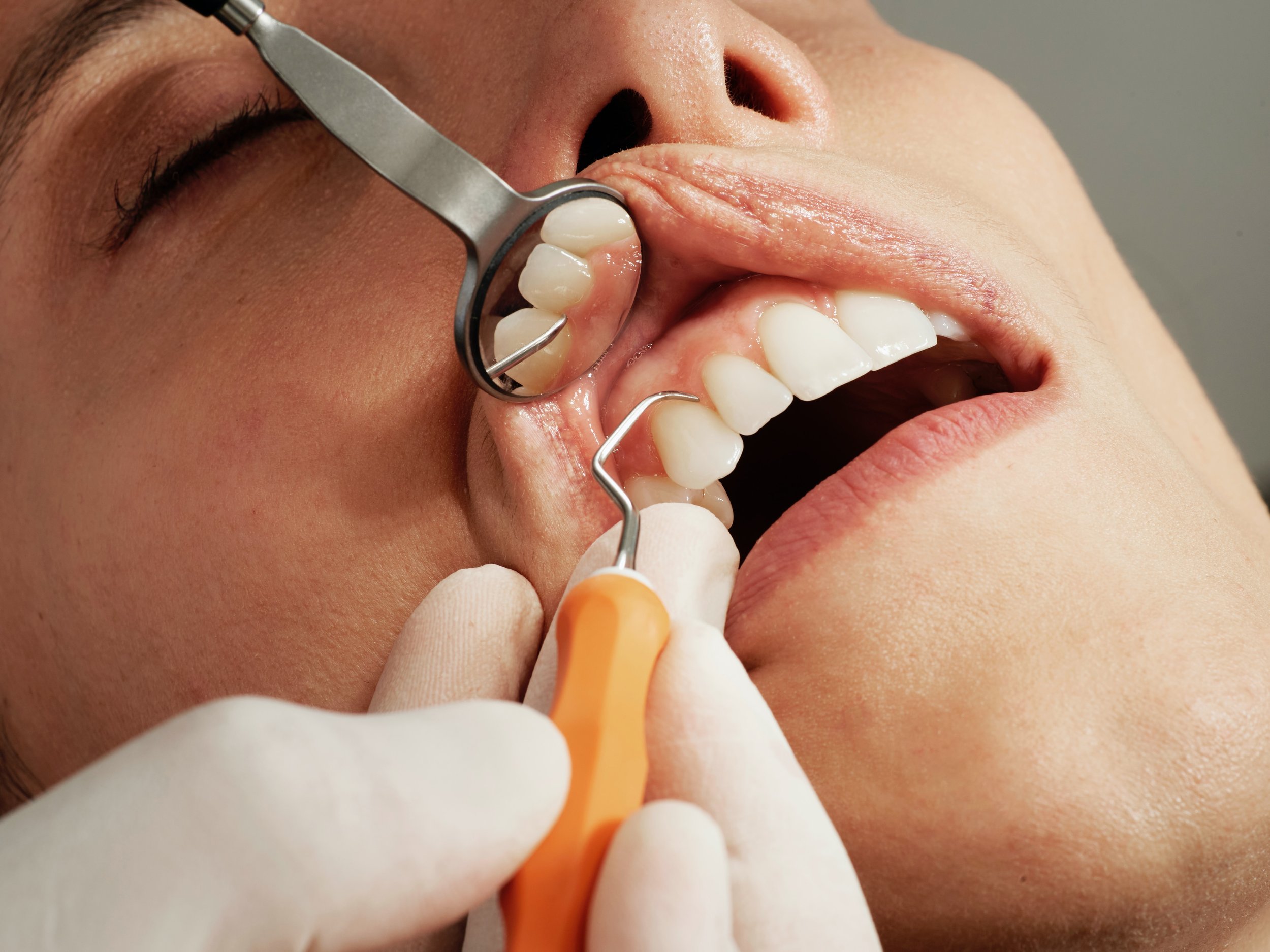 Patient Experience in general dentistry