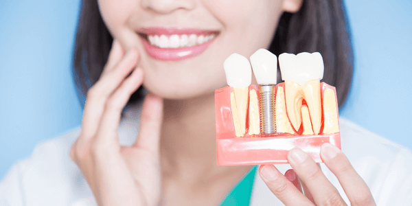 Essential Dental Implants Aftercare