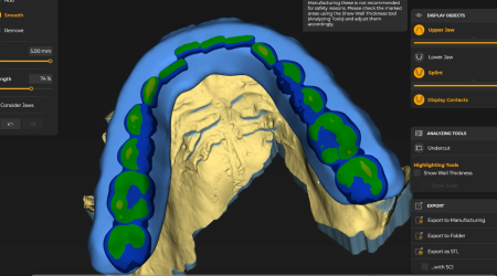 digital dental imaging