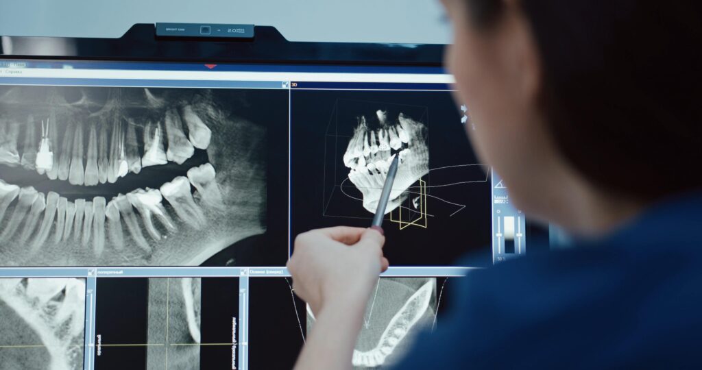 Dental X-rays